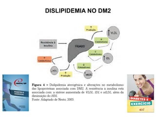 DISLIPIDEMIA NO DM2
 