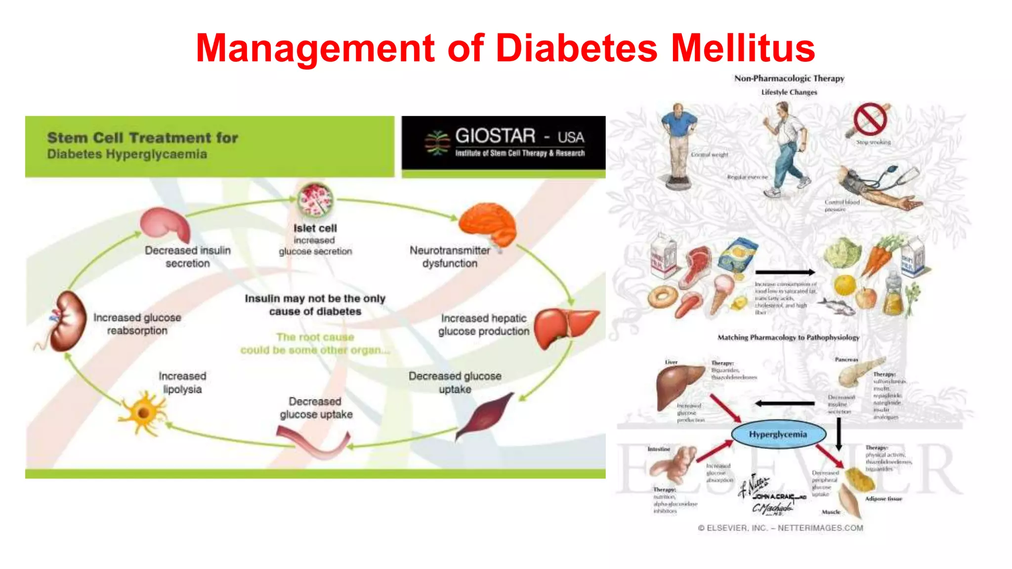 Diabetes | PPTX | Endocrine and Metabolic Diseases | Diseases and ...