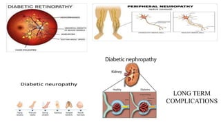 LONG TERM
COMPLICATIONS
 