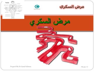 ‫السكري‬ ‫مرض‬‫السكري‬ ‫مرض‬
06-Jan-12Prepared By Dr Gamal Soliman
 