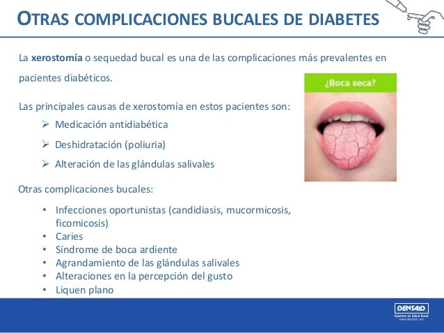 Diabetes y enfermedad periodontal Diabetes y enfermedad periodontal