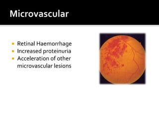  Retinal Haemorrhage
 Increased proteinuria
 Acceleration of other
microvascular lesions
 