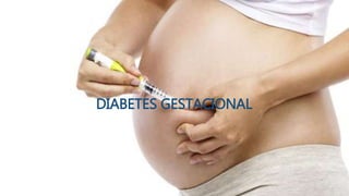 DIABETES GESTACIONAL
 