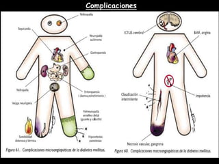 Complicaciones 
 