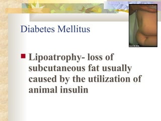 Lipoatrophy- loss of subcutaneous fat usually caused by the utilization of animal insulin Diabetes Mellitus 