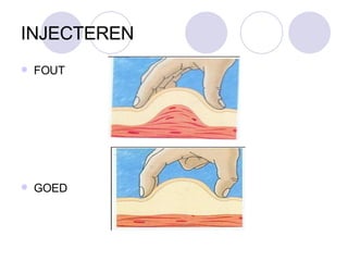 INJECTEREN FOUT GOED 