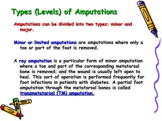 Types (Levels) of Amputations   Amputations can be divided into two types: minor and major.  Minor or limited amputations  are amputations where only a toe or part of the foot is removed. A  ray amputation  is a particular form of minor amputation where a toe and part of the corresponding metatarsal bone is removed; and the wound is usually left open to heal. This sort of operation is performed frequently for foot infections in patients with diabetes. A partial foot amputation through the metatarsal bones is called  transmetatarsal (TM) amputation. 