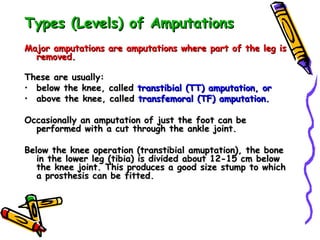 Types (Levels) of Amputations Major amputations are amputations where part of the leg is removed.  These are usually:  below the knee, called  transtibial (TT) amputation, or  above the knee, called  transfemoral (TF) amputation. Occasionally an amputation of just the foot can be performed with a cut through the ankle joint.  Below the knee operation (transtibial amuptation), the bone in the lower leg (tibia) is divided about 12-15 cm below the knee joint. This produces a good size stump to which a prosthesis can be fitted.  