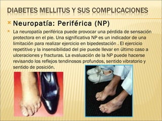 <ul><li>Neuropatía: Periférica (NP) </li></ul><ul><li>La neuropatía periférica puede provocar una pérdida de sensación pro...