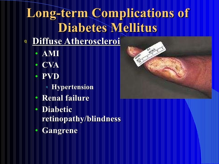 Diabetes Wikipedia