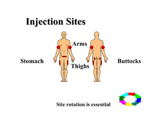 Injection Sites

          .. ..  Arms

Stomach                                Buttocks
                Thighs




          Site rotation is essential
 
