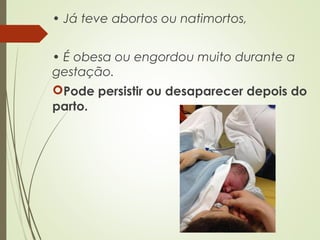 • Já teve abortos ou natimortos,
• É obesa ou engordou muito durante a
gestação.
Pode persistir ou desaparecer depois do
parto.
 