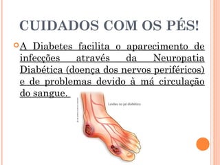 CUIDADOS COM OS PÉS!
A Diabetes facilita o aparecimento de
infecções   através    da    Neuropatia
Diabética (doença dos nervos periféricos)
e de problemas devido à má circulação
do sangue.
 