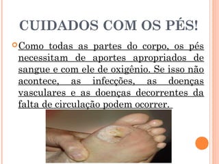CUIDADOS COM OS PÉS!
 Como  todas as partes do corpo, os pés
 necessitam de aportes apropriados de
 sangue e com ele de oxigênio. Se isso não
 acontece, as infecções, as doenças
 vasculares e as doenças decorrentes da
 falta de circulação podem ocorrer.
 