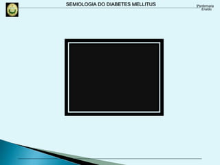 SEMIOLOGIA DO DIABETES MELLITUS
 
