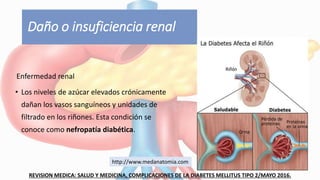 Daño o insuficiencia renal
Enfermedad renal
• Los niveles de azúcar elevados crónicamente
dañan los vasos sanguíneos y unidades de
filtrado en los riñones. Esta condición se
conoce como nefropatía diabética.
REVISION MEDICA: SALUD Y MEDICINA, COMPLICACIONES DE LA DIABETES MELLITUS TIPO 2/MAYO 2016.
http://www.medanatomia.com
 