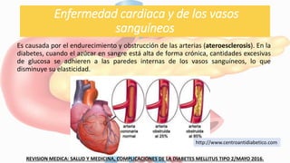 Enfermedad cardiaca y de los vasos
sanguíneos
Es causada por el endurecimiento y obstrucción de las arterias (ateroesclerosis). En la
diabetes, cuando el azúcar en sangre está alta de forma crónica, cantidades excesivas
de glucosa se adhieren a las paredes internas de los vasos sanguíneos, lo que
disminuye su elasticidad.
REVISION MEDICA: SALUD Y MEDICINA, COMPLICACIONES DE LA DIABETES MELLITUS TIPO 2/MAYO 2016.
http://www.centroantidiabetico.com
 