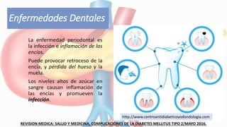 Enfermedades Dentales
La enfermedad periodontal es
la infección e inflamación de las
encías.
Puede provocar retroceso de la
encía, y pérdida del hueso y la
muela.
Los niveles altos de azúcar en
sangre causan inflamación de
las encías y promueven la
infección.
REVISION MEDICA: SALUD Y MEDICINA, COMPLICACIONES DE LA DIABETES MELLITUS TIPO 2/MAYO 2016.
http://www.centroantidiabeticoyodondologia.com
 