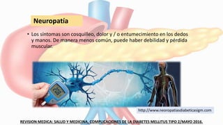 • Los síntomas son cosquilleo, dolor y / o entumecimiento en los dedos
y manos. De manera menos común, puede haber debilidad y pérdida
muscular.
REVISION MEDICA: SALUD Y MEDICINA, COMPLICACIONES DE LA DIABETES MELLITUS TIPO 2/MAYO 2016.
Neuropatía
http://www.neoropatiasdiabeticasigm.com
 