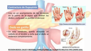 • Esto es un acortamiento de los tendones
en la palma de la mano que doblan los
dedos y evita que se puedan enderezar.
• En esta condición, queda atrapado un
nódulo en el tendón y evita que el dedo se
enderece completamente.
REVISION MEDICA: SALUD Y MEDICINA, COMPLICACIONES DE LA DIABETES MELLITUS TIPO 2/MAYO 2016.
Contractura de Dupuytrén
Dedo en gatillo
http://www.centroantidiabetico.com
 