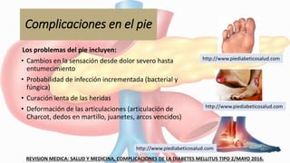Complicaciones en el pie
Los problemas del pie incluyen:
• Cambios en la sensación desde dolor severo hasta
entumecimiento
• Probabilidad de infección incrementada (bacterial y
fúngica)
• Curación lenta de las heridas
• Deformación de las articulaciones (articulación de
Charcot, dedos en martillo, juanetes, arcos vencidos)
REVISION MEDICA: SALUD Y MEDICINA, COMPLICACIONES DE LA DIABETES MELLITUS TIPO 2/MAYO 2016.
http://www.piediabeticosalud.com
http://www.piediabeticosalud.com
http://www.piediabeticosalud.com
 