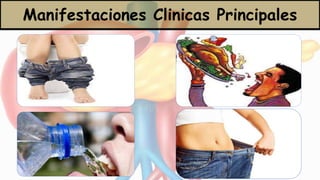 Manifestaciones Clinicas Principales
 