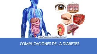 COMPLICACIONES DE LA DIABETES
http://www.centroantidiabetico.com
 