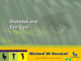 Diabetes and Eye Care 