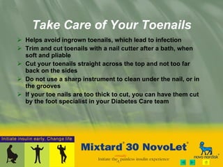 Take Care of Your Toenails Helps avoid ingrown toenails, which lead to infection Trim and cut toenails with a nail cutter after a bath, when soft and pliable Cut your toenails straight across the top and not too  far back on the sides Do not use a sharp instrument to clean under the nail, or in the grooves If your toe nails are too thick to cut, you can have them cut by the foot specialist in your Diabetes Care team 