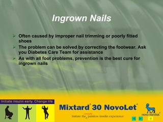 Often caused by improper nail trimming or poorly fitted shoes  The problem can be solved by correcting the footwear. Ask you Diabetes Care Team for assistance As with all foot problems, prevention is the best cure for ingrown nails  Ingrown Nails 
