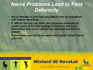 Nerve Problems Lead to Foot Deformity Nerve damage in your feet may lead to loss of sensations and muscle weakness  It  affects the way you walk, and increases pressure on certain parts of the feet leading to fractures and bony deformities that occur without any apparent accident or reason It decreases your ability to sweat and impairs blood flow to your feet 