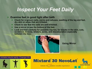 Inspect Your Feet Daily Examine feet in good light after bath  Check for  i n-grown nails, corns and calluses, swelling of the leg and feet, dry skin or areas that are irritated. Check to see that the nails are well trimmed. Use a mirror to see the bottom of  the feet. Look  and feel  carefully for possible injuries,  for breaks in the skin, cuts, scratches, bruises, blisters, sores, and discolouration especially between the toes.  Using Mirror 
