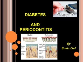 DIABETES
AND
PERIODONTITIS
By
Sunia Gul
 