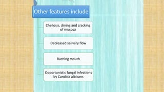 Other features include
Cheilosis, drying and cracking
of mucosa
Decreased salivary flow
Burning mouth
Opportunistic fungal infections
by Candida albicans
 
