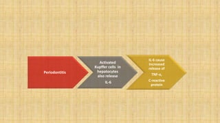 Periodontitis
Activated
Kupffer cells in
hepatocytes
also release
IL-6
IL-6 cause
Increased
release of
TNF-⍺,
C-reactive
protein
 