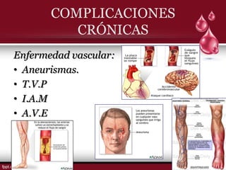 COMPLICACIONES
          CRÓNICAS
Enfermedad vascular:
• Aneurismas.
• T.V.P
• I.A.M
• A.V.E
 