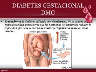 DIABETES GESTACIONAL
                 DMG
• Es una forma de diabetes inducida por el embarazo. No se conoce una
  causa específica ,pero se cree que las hormonas del embarazo reducen la
  capacidad que tiene el cuerpo de utilizar y responder a la acción de la
  insulina.
 