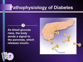 Pathophysiology of Diabetes
As blood glucose
rises, the body
sends a signal to
the pancreas, which
releases insulin.
7
 