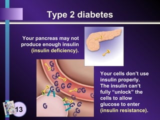 Type 2 diabetes
Your cells don’t use
insulin properly.
The insulin can’t
fully “unlock” the
cells to allow
glucose to enter
(insulin resistance).
Your pancreas may not
produce enough insulin
(insulin deficiency).
13
 
