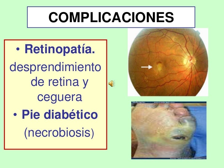 Diabetes con sonido junio 2011 Diabetes con sonido junio 2011