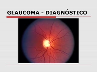 GLAUCOMA - DIAGNÓSTICO

 