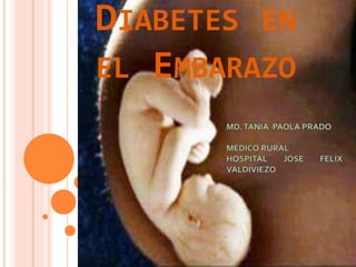 DIABETES EN
EL EMBARAZO
 