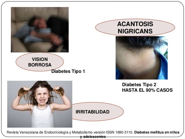 Diabetes en infancia y adolescencia Diabetes en infancia y adolescencia