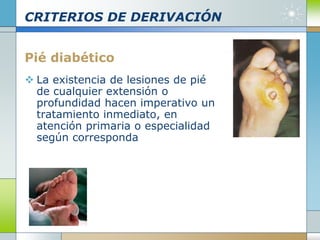 CRITERIOS DE DERIVACIÓN
Pié diabético
 La existencia de lesiones de pié
de cualquier extensión o
profundidad hacen imperativo un
tratamiento inmediato, en
atención primaria o especialidad
según corresponda
 