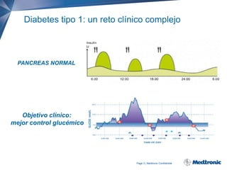 Diabetes tipo 1: un reto clínico complejo

PANCREAS NORMAL

Objetivo clínico:
mejor control glucémico

Page 3 | Medtronic Confidential

 