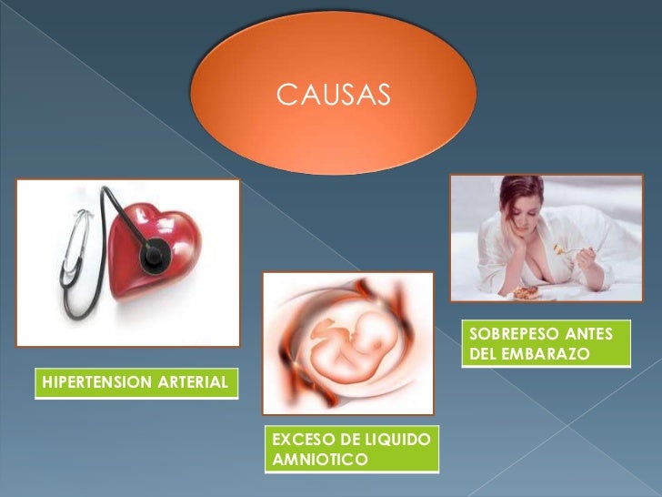 Diabetes gestacional Diabetes gestacional