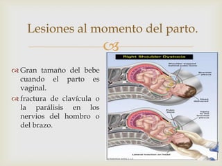 Lesiones al momento del parto.
                            
 Gran tamaño del bebe
  cuando el parto es
  vaginal.
 fractura de clavícula o
  la parálisis en los
  nervios del hombro o
  del brazo.
 