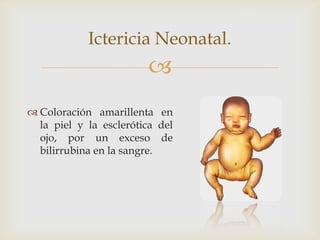 Ictericia Neonatal.
                        
 Coloración amarillenta en
  la piel y la esclerótica del
  ojo, por un exceso de
  bilirrubina en la sangre.
 