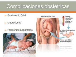  Sufrimiento fetal
 Macrosomía
 Problemas neonatales
 