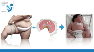 11
medicina
materno
fetal
HNDAC
+
 